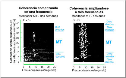 Coherencia Cerebral